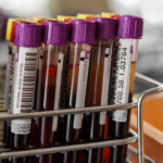 Polycytemia vera: orsak, symtom & behandling